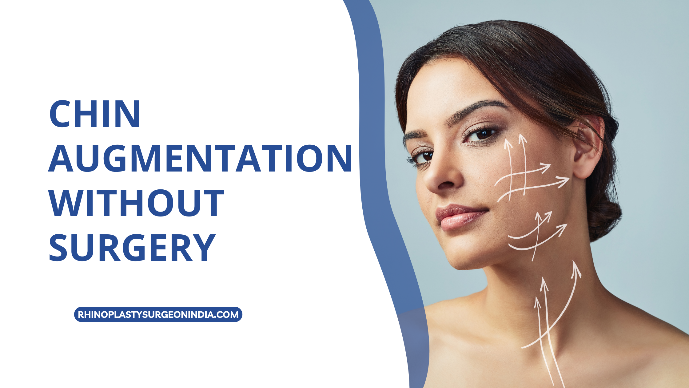Chin Augmentation without surgery