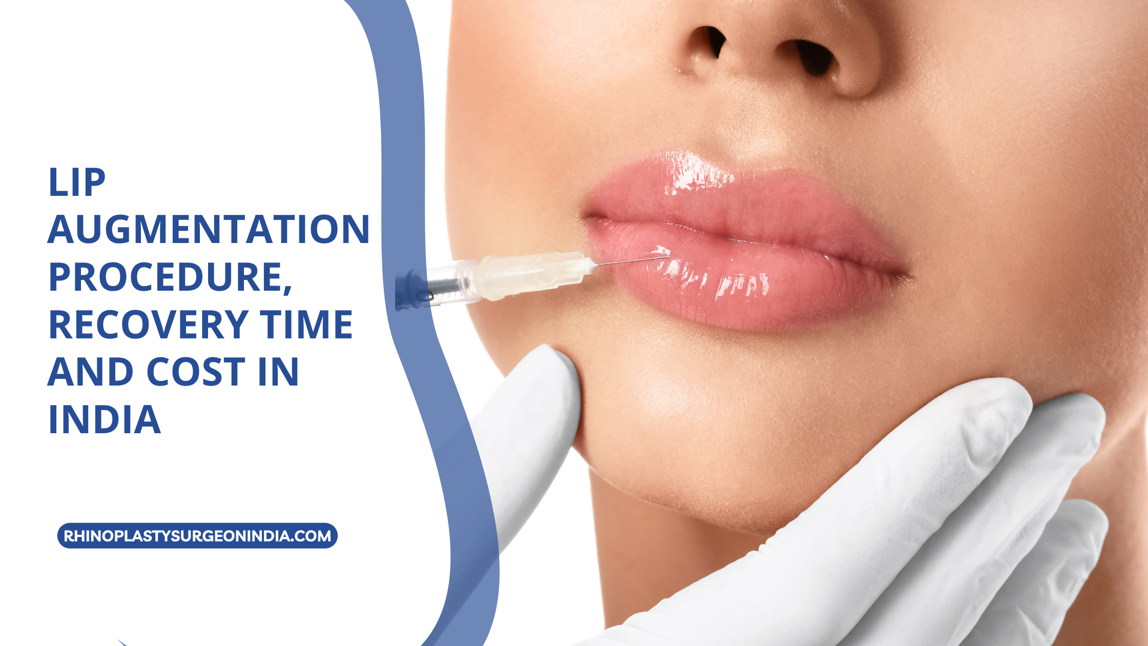 Lip Augmentation Procedure, Recovery Time and Cost in India