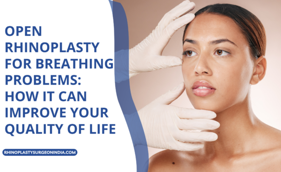 Open Rhinoplasty for Breathing Problems: How It Can Improve Your Quality of Life