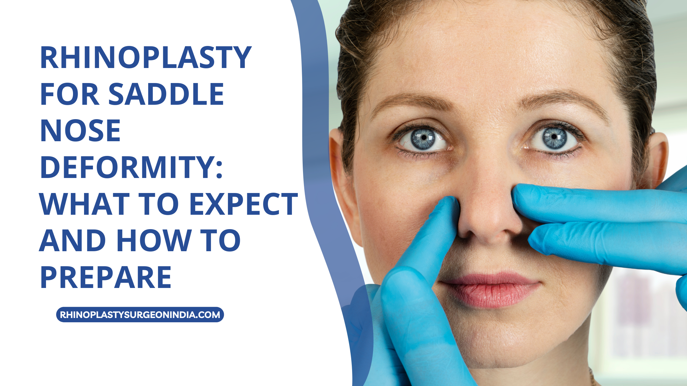 Rhinoplasty for Saddle Nose Deformity: What to Expect and How to Prepare