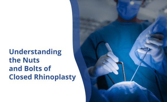 Closed Rhinoplasty | Rhinoplasty Surgeon India