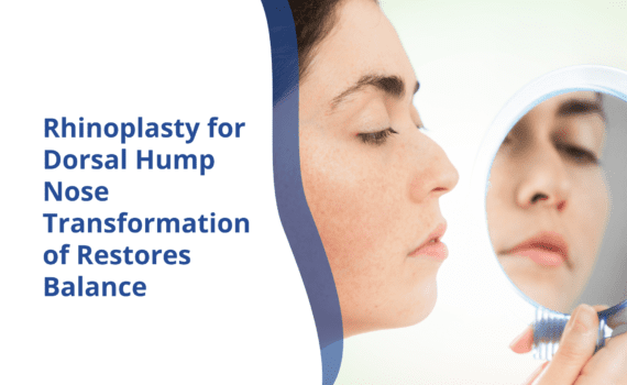 Dorsal Hump Nose | Rhinoplasty Surgeon India